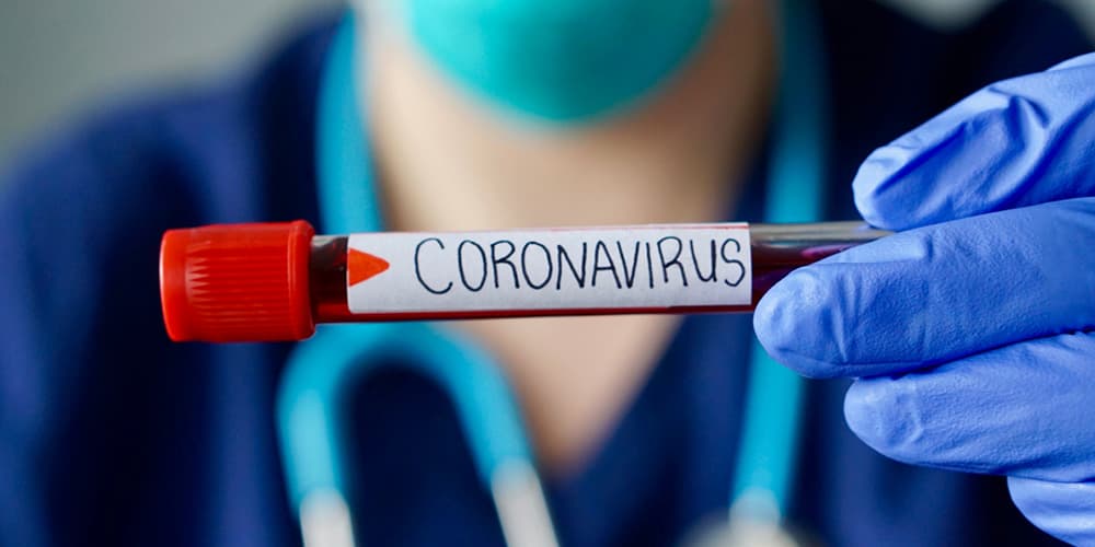 Corona Virüs – Covid19